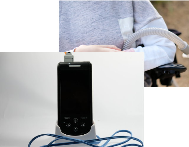 Medical Device Image